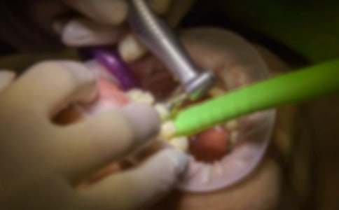 媽媽拔牙作文(精選34篇)