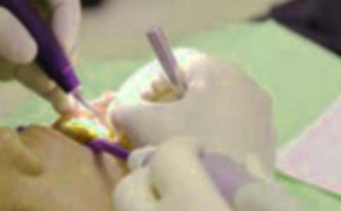 用奶糖拔牙初一記敘文作文