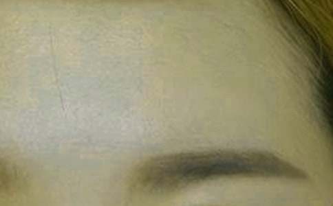 �茑(xi��)����üë�ľ���