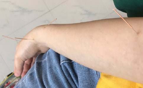 2016中醫(yī)助理醫(yī)師針灸學系統(tǒng)備考重點